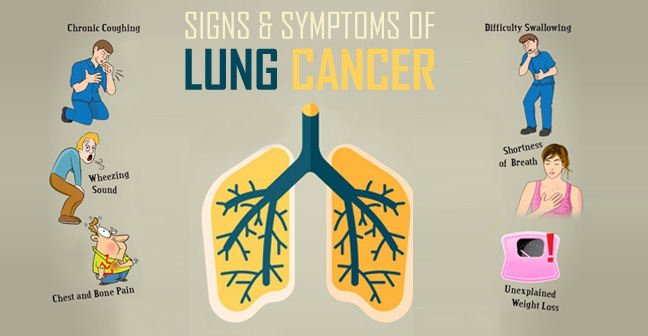 Increasing Lung cancer in Delhi