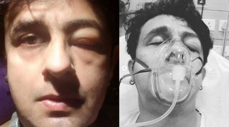 Popular Singer Sonu Nigam Shares ICU Pics !