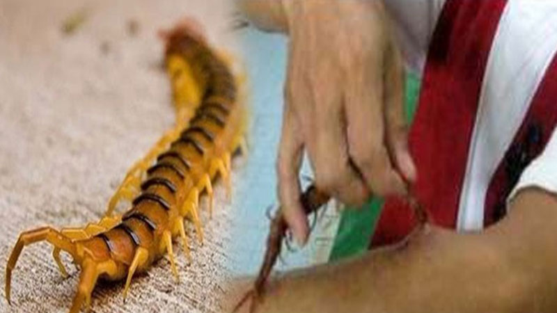 अगर किसी व्यक्ति को कनखजूरा काट ले, तो जाने आखिर क्या हो सकता है उस व्यक्ति के साथ Youth Express