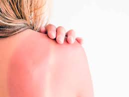 त्वचा को निखारने में